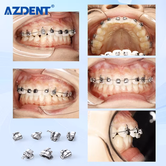 Équipements dentaires, supports de dents orthodontiques, supports Autoligables, odontologie Roth/Slide, supports auto-ligaturants